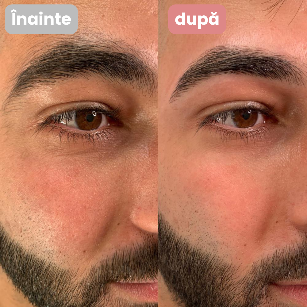 EasyBrow™ Eyebrow and Facial Hair Device