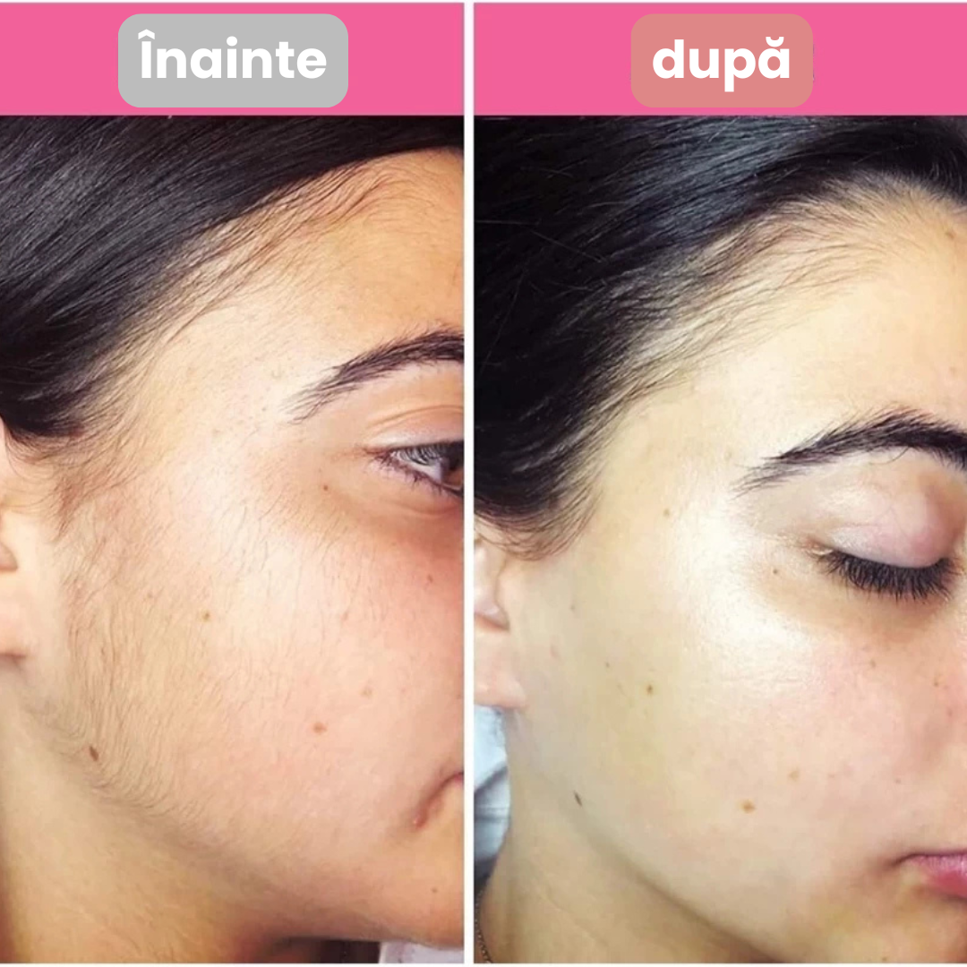 EasyBrow™ Eyebrow and Facial Hair Device